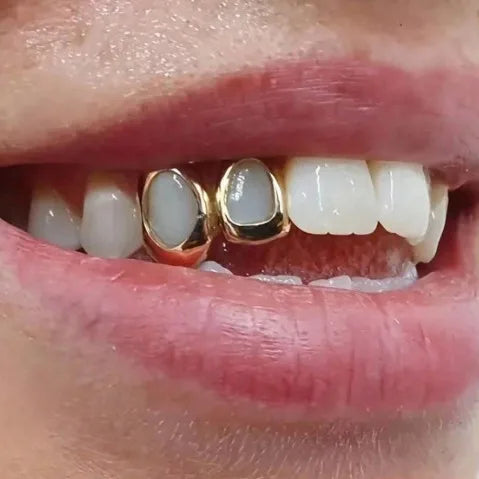 Grillz 2 dents — Doumira